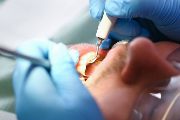 Best Emergency Dental Care for Broken or Chipped Teeth in Locust Grove, GA