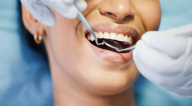Best Emergency Wisdom Teeth Removal in Locust Grove, GA