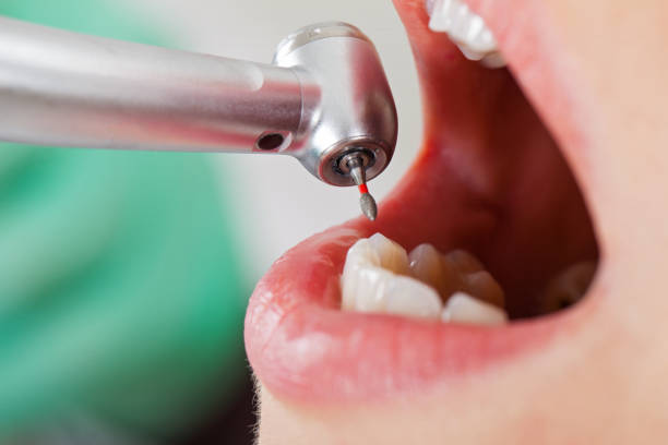 Best Pediatric Emergency Dentist in Locust Grove, GA